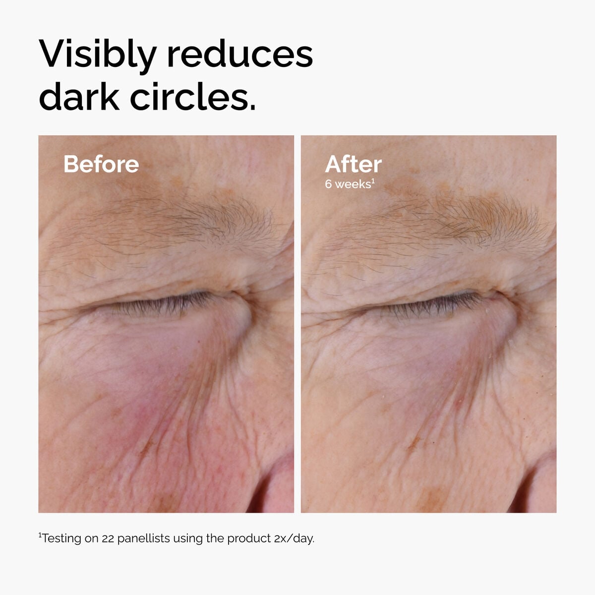 caffeine-solution-5-egcg-eye-serum-a6 ord-caffeine-solution-egcg-dark-circles-before-after.jpg