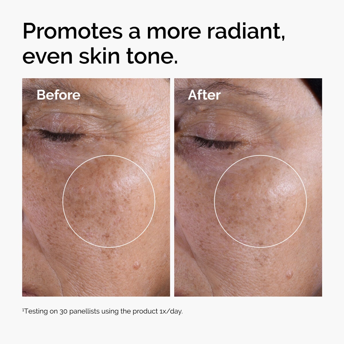 glycolic-acid-7-exfoliating-toner-y8 ord-glycolic-before-after-radiance.jpg