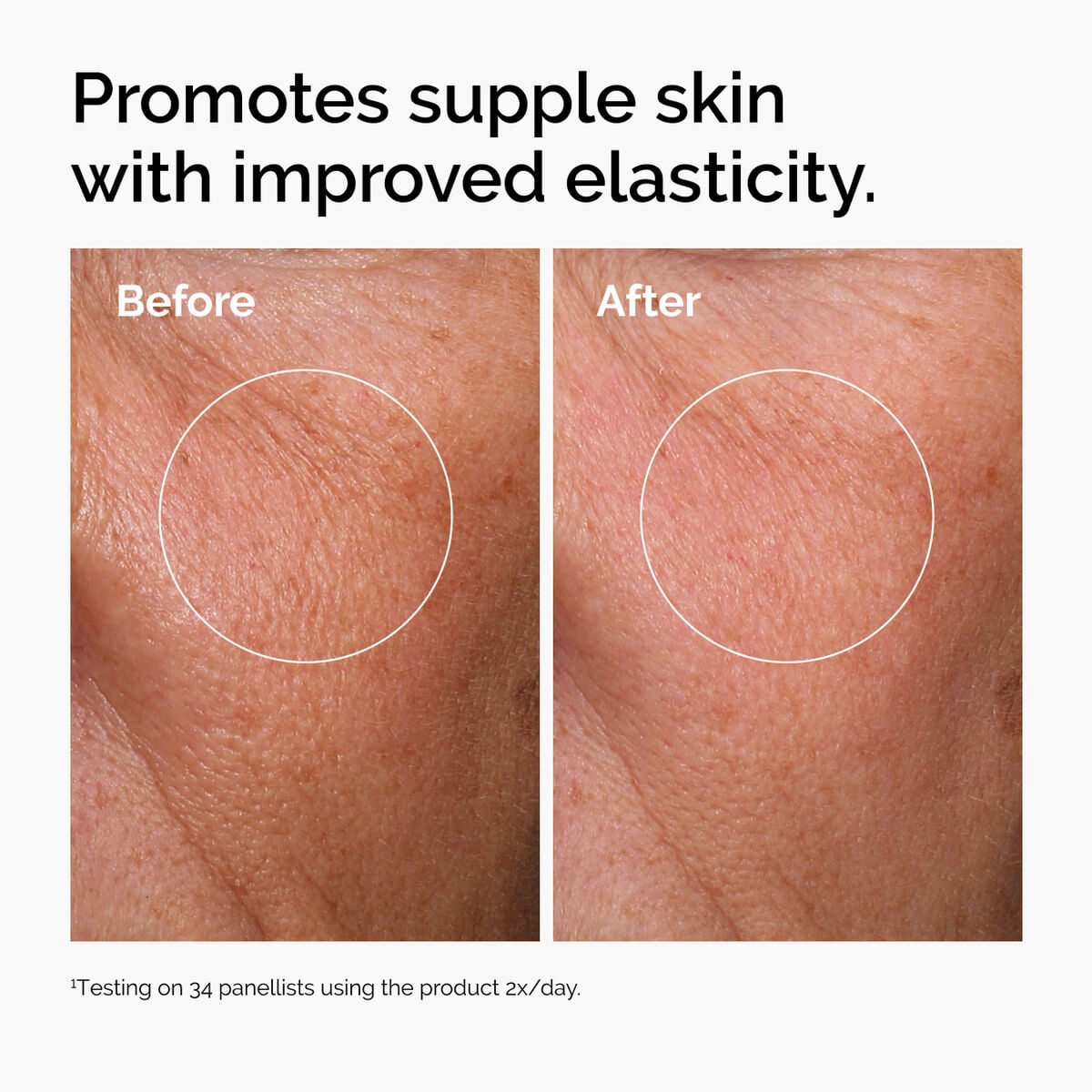 hyaluronic-acid-2-b5-with-ceramides-h9 ord-hyaluronic-acid-2pct-b5-hydrating-serum-before-after-elasticity.jpg