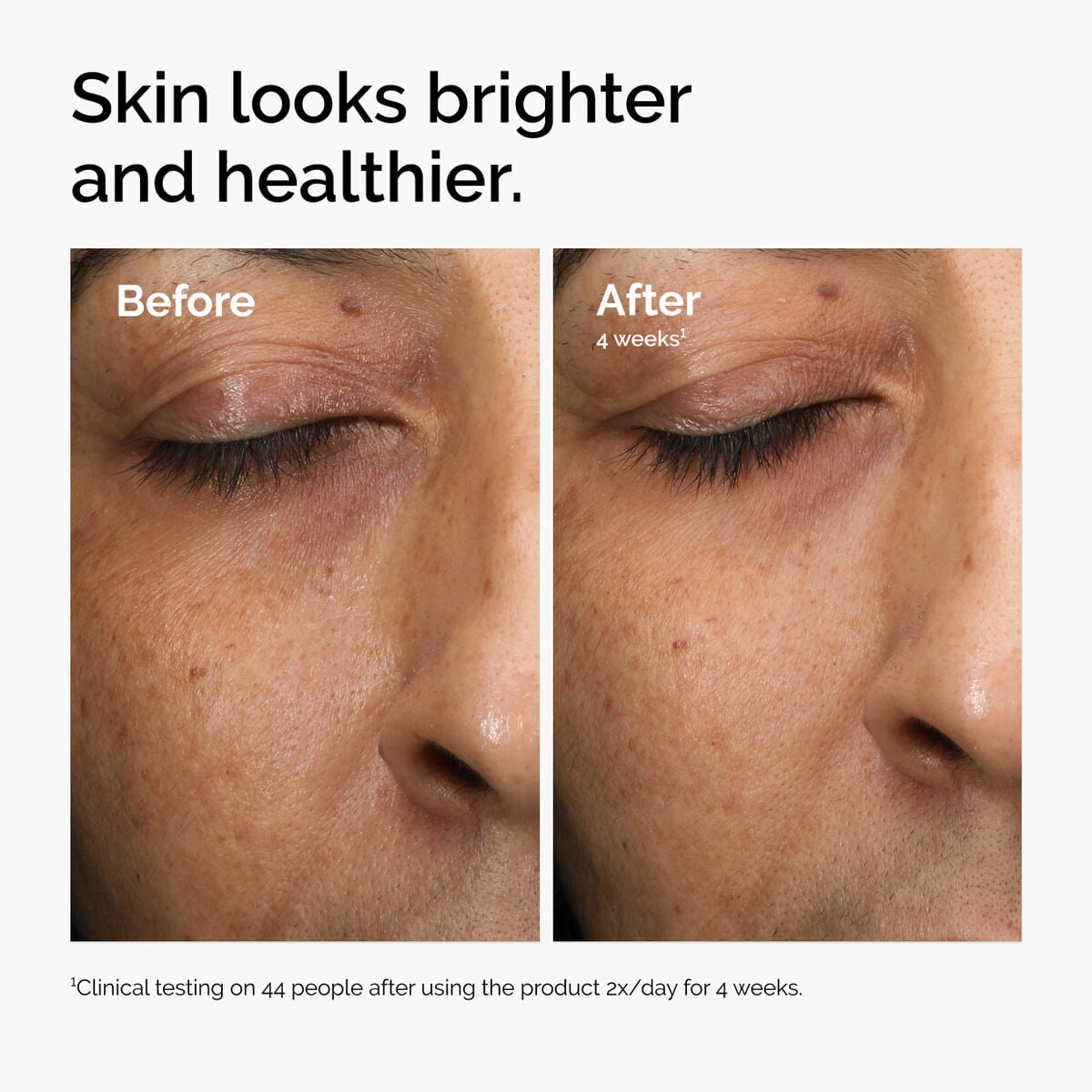 multi-antioxidant-radiance-serum-f4 ord-mars-before-after-healthy.jpg