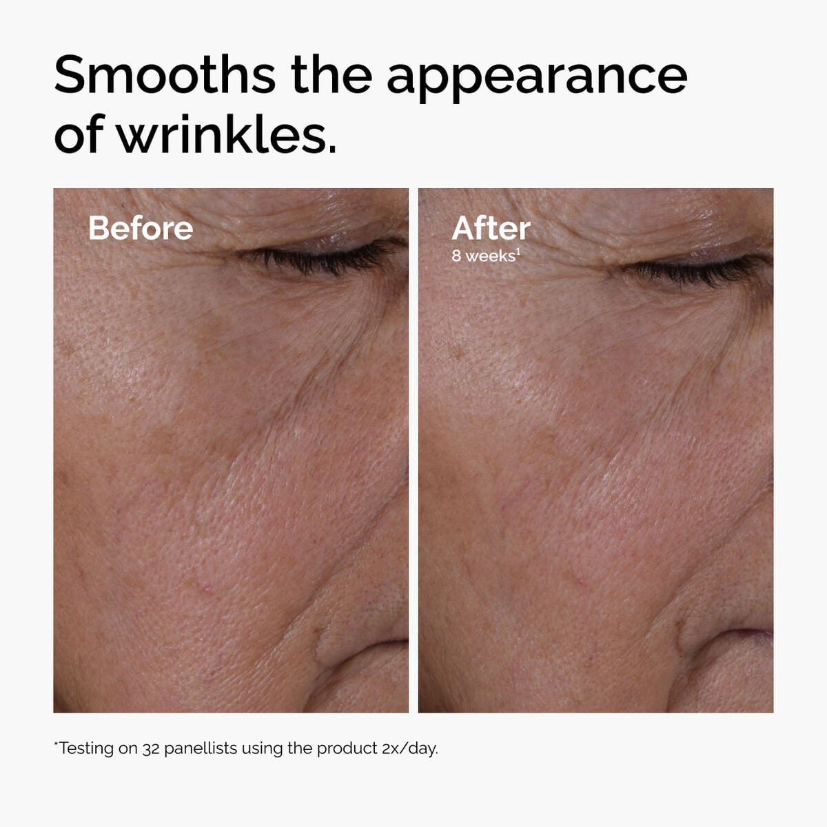 multi-peptide-ha-serum-k3 ord-multi-peptide-ha-serum-wrinkles-before-after.jpg