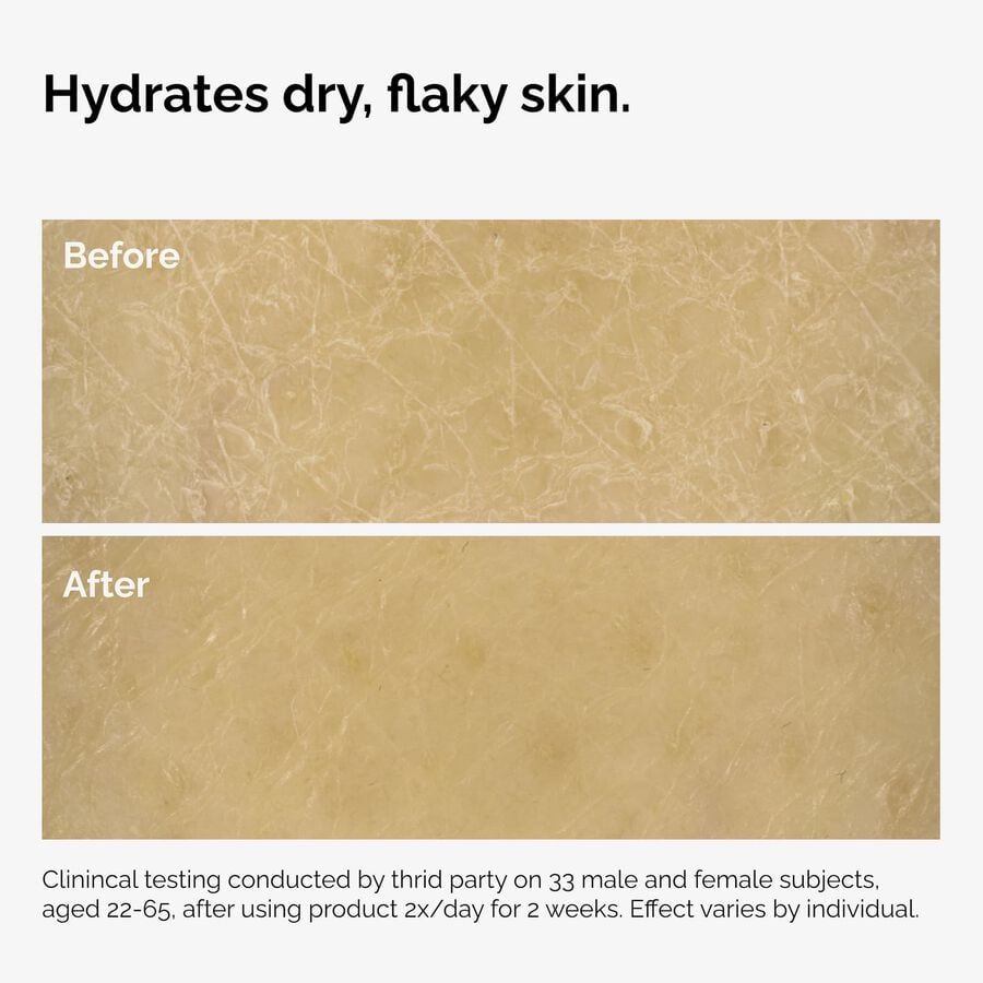 the-body-care-collection-u2 ord-natural-moisturizing-factors-inulin-body-before-after-graphic-02.jpg