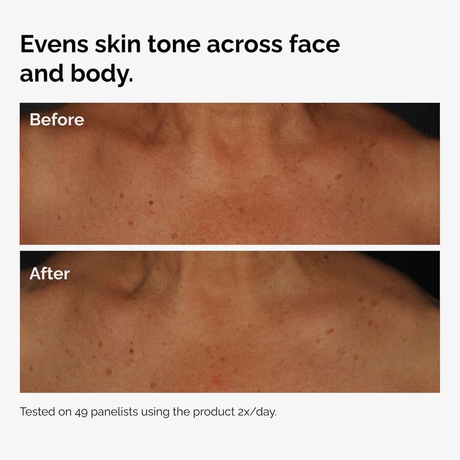 the-body-care-collection-u2 ord-niacinamide-face-body-serum-before-after-even-tone-graphic.jpg