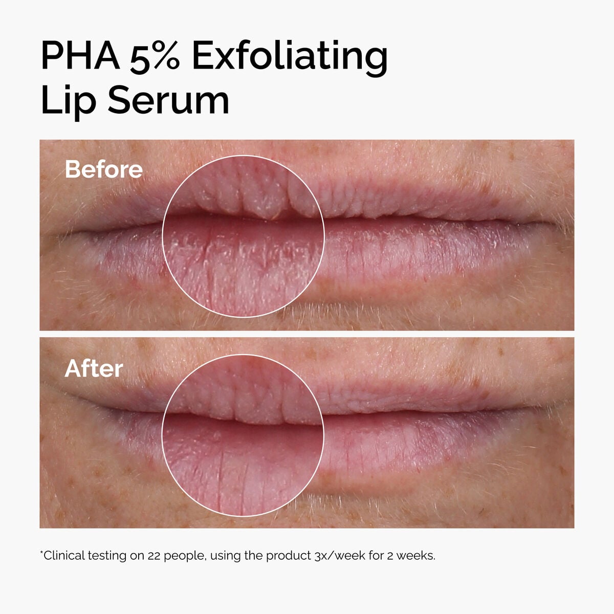 pha-5-exfoliating-lip-serum-b1 ord-pha-5pct-lip-exfoliating-serum-before-after.jpg