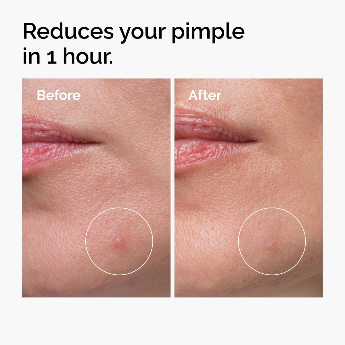 sulfur-10-powder-to-cream-concentrate-v4 ord-sulfur-10pct-powder-to-cream-concentrate-before-after-NA.jpg